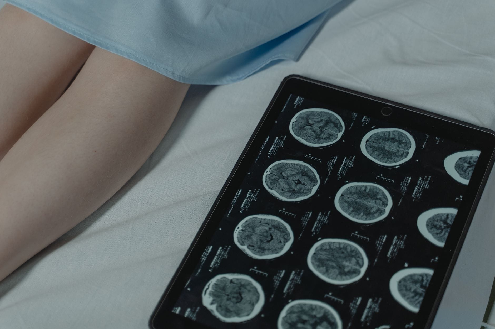 Close-up of brain CT scan display on tablet beside patient's legs in a hospital room.